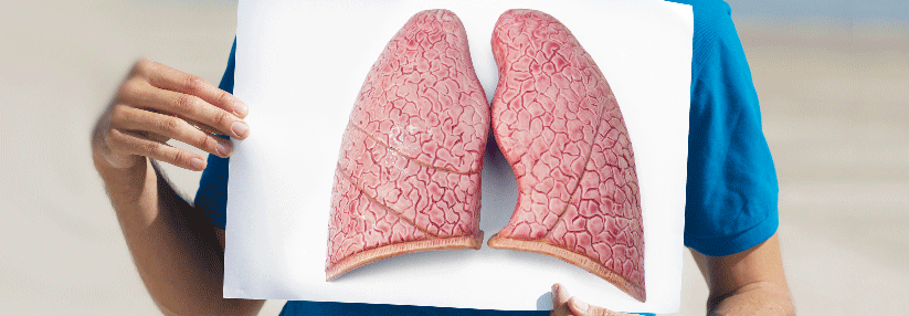 Das Gesamtüberleben bei nicht-plattenepithelialen Lungentumoren hat sich etwa verdoppelt.