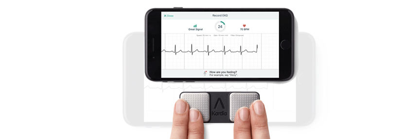 Mit einem winzigen Gerät und der dazu­gehörigen App können Patienten ihr EKG selbst aufzeichnen. Ein Kardiologe wertet es aus.