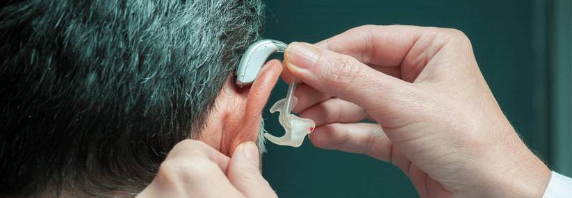 Bei Cochleaimplantaten und Hörgeräten zählt bisher nur die Sprachverständlichkeit.