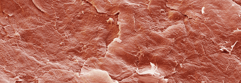 Xerosis cutis – die richtige Basistherapie Eines der Hauptziele der Basistherapie bei Xerosis cutis ist die Wiederherstellung der Barrierefunktion.