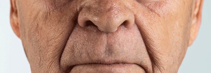 Das Abschneiden im objektiven Geruchstest stellt einen guten Indikator für den Gesundheitszustand älterer Menschen dar.