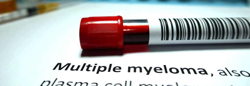 Im Blick: Neue Wirkstoffe zur Behandlung des Multiplen Myeloms.