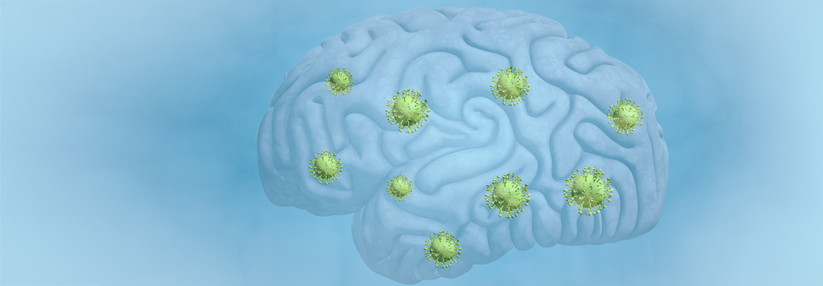 Nach dem Wechsel auf eine Immuntherapie wuchsen die Hirnmetastasen wieder.