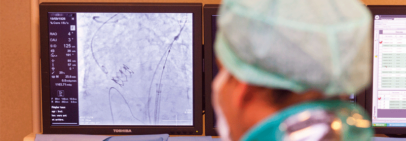 Über einen Katheter schiebt man die Prothese an die Stelle der kranken Valva aortae. Die alte Klappe wird an die Aortenwand gedrückt.