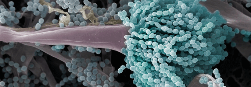 Unter dem Rasterelektronenmikroskop macht Aspergillus fumigatus viel her. In der Lunge kann der Pilz große Schäden anrichten.