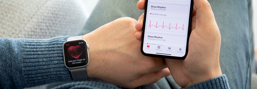 Mit einer Smartwatch und der zugehörigen App kann jeder sein EKG selbst aufzeichnen.