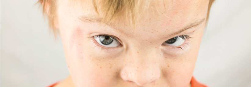 Rund 85 % der Kinder und Jugendlichen mit Down-Syndrom leiden an Sehstörungen wie z.B. Refraktionsanomalien.