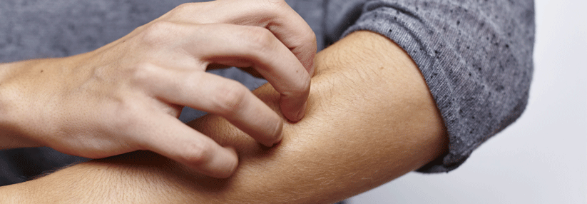 Endlich ausgeschuppt Interleukin-Inhibition vertreibt die Plaque-Psoriasis.