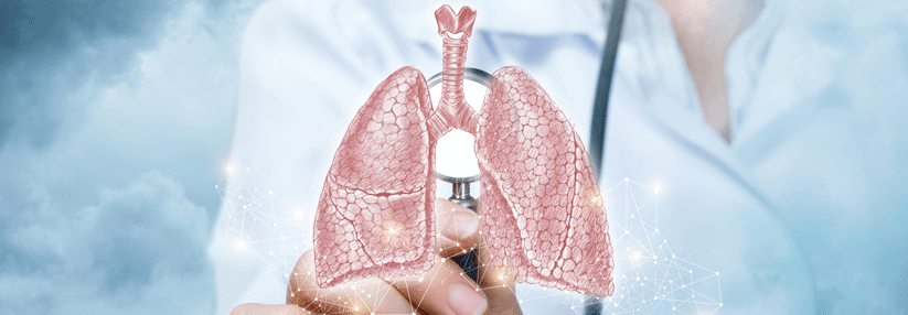 Beim kleinzelligen Lungenkarzinom (SCLC) stehen wenige Behandlungsoptionen zur Verfügung. 