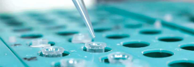PARP-Inhibitor jetzt auch bei Brustkrebs Der Nachweis einer Keimbahnmutation der Gene BRCA1 und BRCA2 kann mittels einer Untersuchung des Blutes erfolgen und hat Einfluss auf die weitere Therapie.