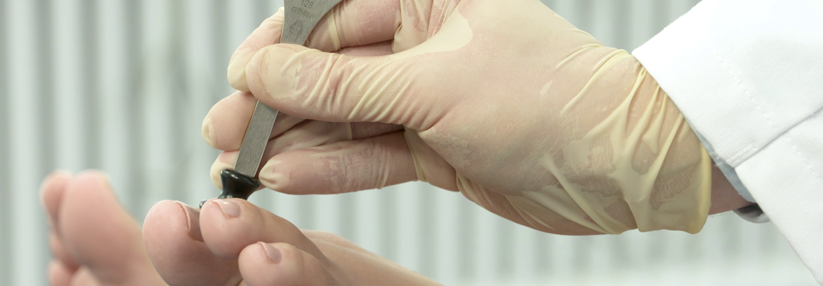 Leitliniengerechte Untersuchung auf diabetische Neuropathie Insbesondere bei der Stimmgabel-Untersuchung lauern Fehlerquellen.