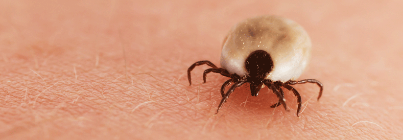 Kutane Erstmanifestation Jahre nach Zeckenstich - effektive Behandlung mit Ceftriaxon.