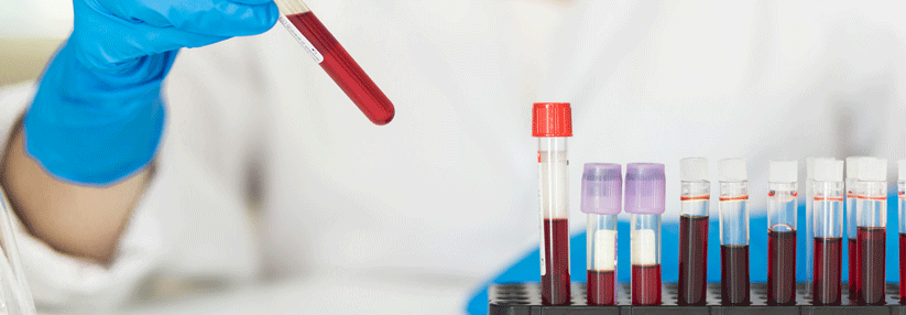 Wie kam man auf die Idee, die ungenügenden Ergebnisse zum Bluttest in die Öffentlichkeit zu bringen?