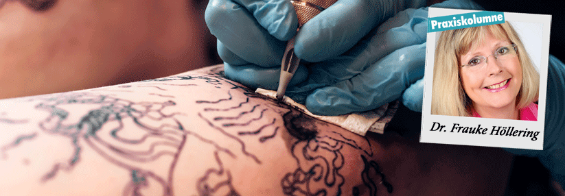 Laut Dr. Höllering muss das Tattoo auh zum Charakter der Person passen. 