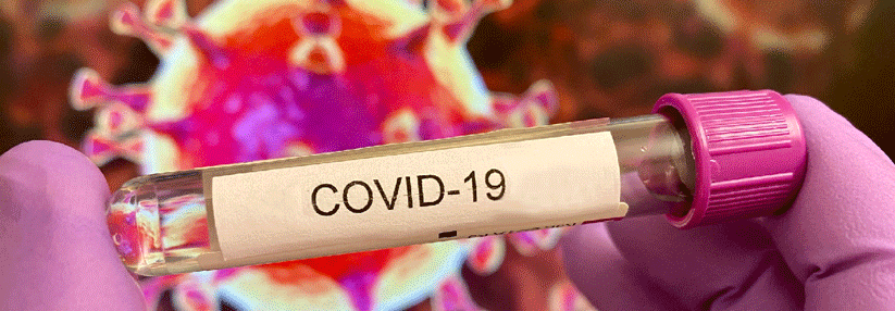 Insgesamt können die Labore die Belastung durch das Coronavirus derzeit offenbar gut stemmen.
