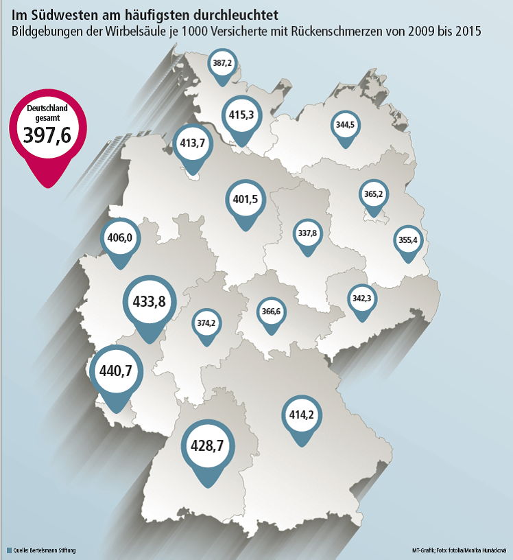 Bildgebungen der Wirbelsäule je 1000 Versicherte mit Rückenschmerzen von 2009 bis 2015.