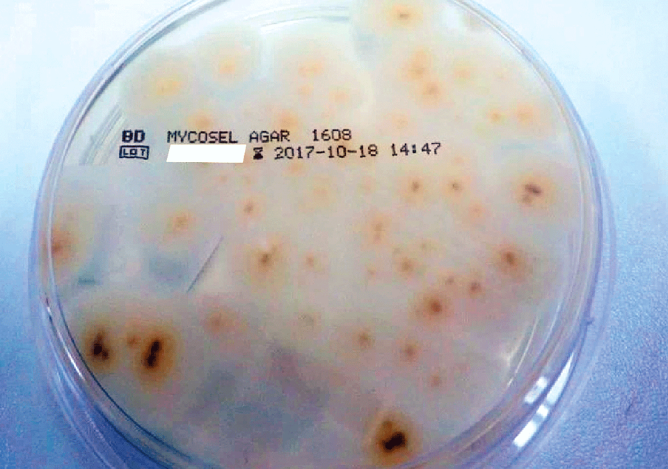 Im Labor bestätigte sich eine Infektion mit Trichophyton erinacei.