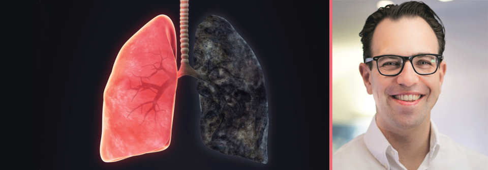 COPD: Steroid-Auslassversuch wagen! „Der Pneumologe ist bei häufigen Exazerbationen gefragt“.