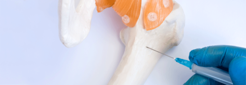 Manchmal zahlt sich eine Knochenmarkpunktion auch bei über 90-Jährigen aus