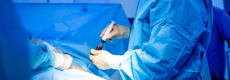 Transplantations-Patienten lange nachbeobachten