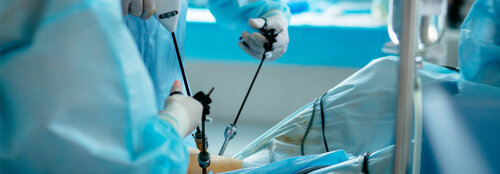 Minimalinvasive Pankreatektomie nicht unterlegen