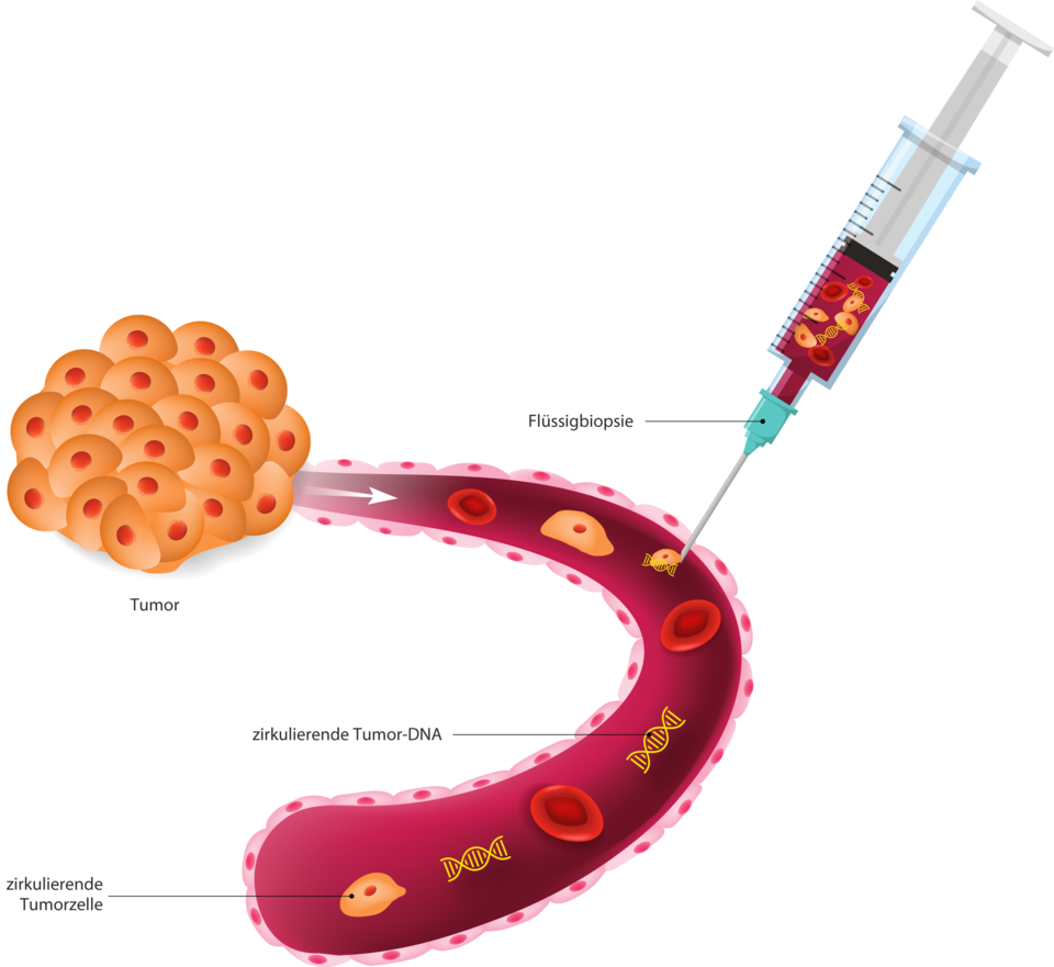 Blutabnahme bei einer Flüssigbiopsie