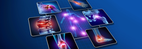 Rheumatoide Arthritis in der Hausarztpraxis diagnostizieren