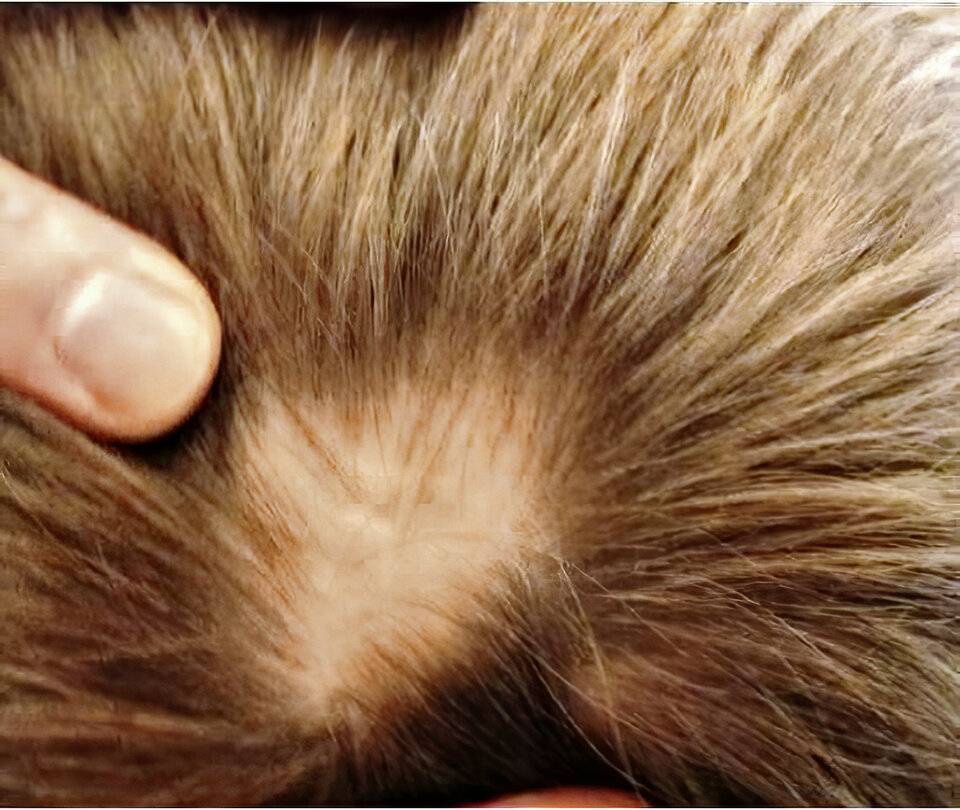 Abb. 2a: Alopecia areata bei einem Kind mit florider Zöliakie