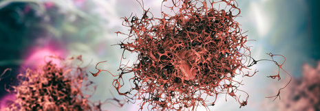 Multiples Myelom: Effektivität von CAR-T-Zellen erhöhen