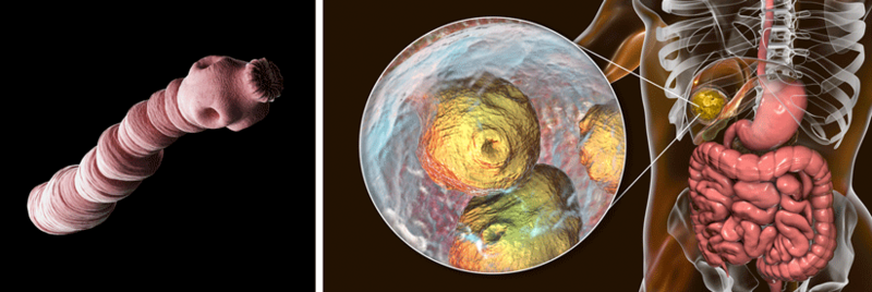 Echinococcus multilocularis Zyste