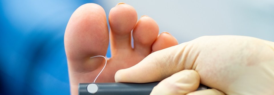 Aktuelle Empfehlungen zum Management der diabetischen Neuropathie