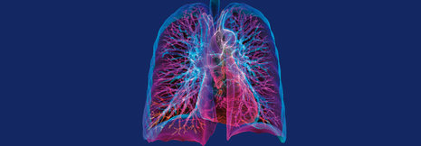 Mit welcher Dosis lassen sich kardiale Risiken unter Thorax-Radiatio senken?
