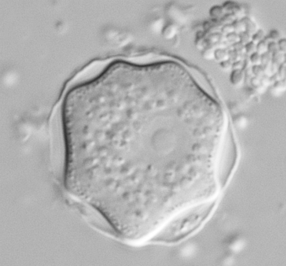 Akanthamöben-Zysten in der Interferenzkontrastmikroskopie