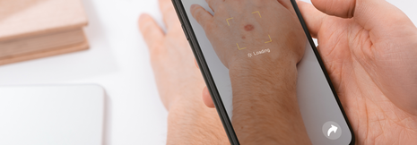 Hautkrebsscreening über App zu ungenau