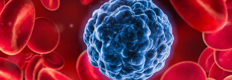 Zulassungseinschränkung bei chronischer myelomonozytärer Leukämie infrage gestellt