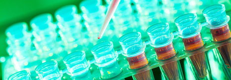 Neuer Blasenkrebs-Marker zeigt, wer auf neoadjuvante Chemotherapie anspricht