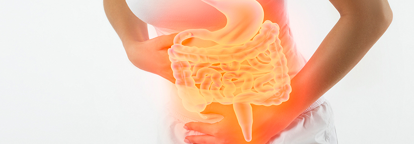 Die Symptome bei einem Reizdarm können Schmerzen, Diarrhö, Flatulenz und Obstipation umfassen – einzeln oder in Kombination. 