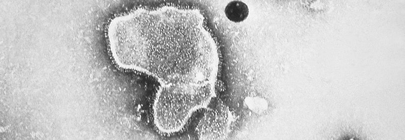 Das RS-Virus variiert in Form und Größe und ist Hauptursache für Pneumonien bei Säuglingen.