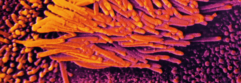 In entzündeten Nasenschleimhäuten von Pollenallergikern wachsen mehr und längere Cilien. Aufnahme via Rasterelektronenmikroskop.