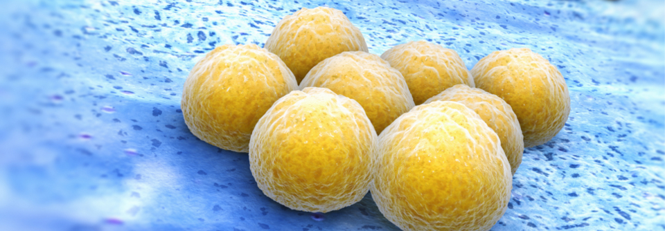 Staphylococcus hominis reduziert Staph.-aureus-Belastung Die Menge an Staphylococcus aureus nahm bei den Behandelten ab, die Toxinproduktion ging zurück und es traten weniger AD-verbundene unerwünschte Ereignisse auf.