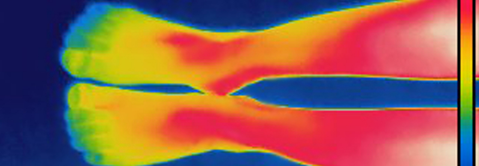 Die plantaren Temperaturen lagen bei den Rheumatikern in ihrer Studie um etwa 1–1,5 °C höher als bei den Kontrollpersonen. (Agenturfoto)