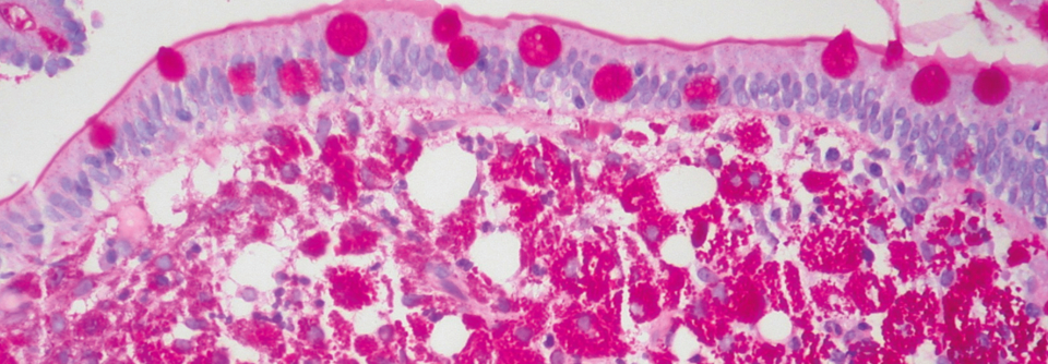Mittels PAS-Reaktion lassen sich in der Lamina propria von Patienten mit M. Whipple schaumzellige Makrophagen nachweisen.