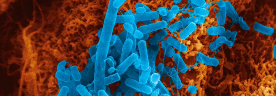 Wird Pseudomonas in der Lunge erstmals nachgewiesen, gelingt die Eradikation zu 50 %.