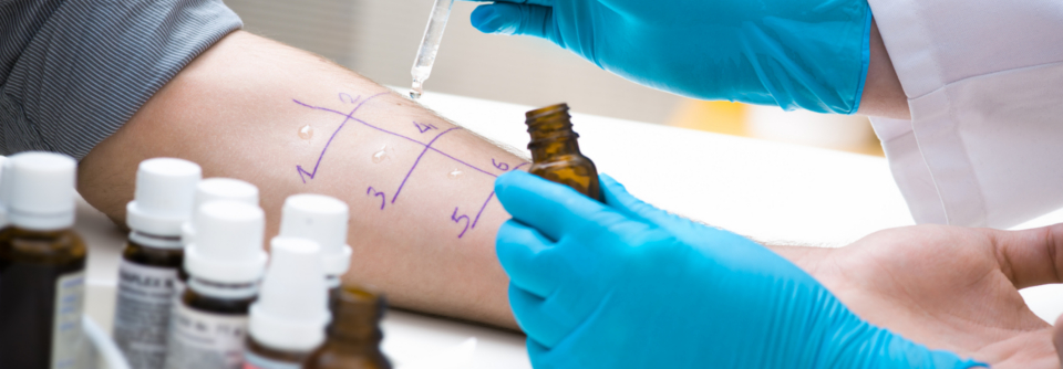 Spickzettel für die Allergiediagnostik