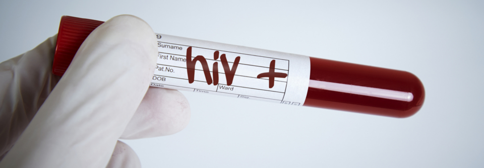 Nur wenn man die typischen Zeichen und Zusammenhänge erkennt, kann rechtzeitig ein HIV-Test in die Wege geleitet und früh behandelt werden.
