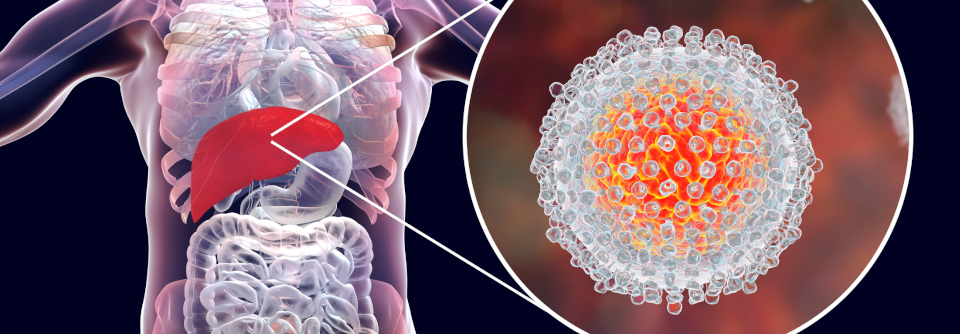 Das RKI bittet Ärzte, vermehrt auf akute Hepatitis oder Leberversagen bei Kindern unter 16 Jahren zu achten und diese an das Gesundheitsamt zu melden.