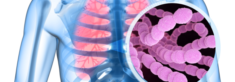 Wahrscheinlich werden sich Pneumokokkenpneumonien und invasive Pneumokokkenerkrankungen damit wirksamer verhindern lassen als bislang.