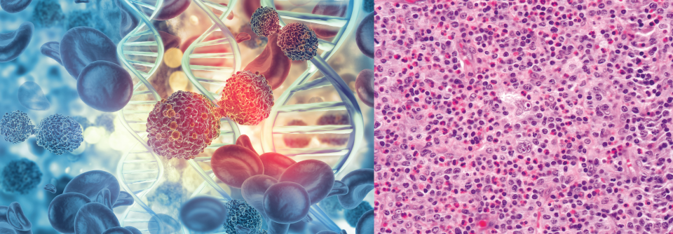 Momentan werden den Impfungen gegen SARS-CoV2 viele unerklärliche Beschwerden zugeschrieben. Dabei ist die Impfreaktion meist nur eine von zahlreichen Differenzialdiagnosen.