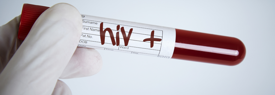 Ältere Menschen mit beträchtlich erhöhtem Risiko für eine HIV-Infektion sollten über die Möglichkeit der Präexpositionsprophylaxe aufgeklärt werden.