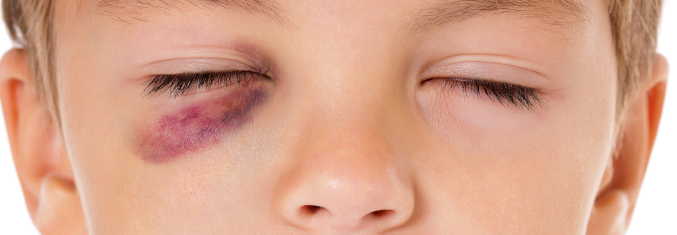 Im Schulsport ist der Anteil an Augenverletzungen seit Jahren rückläufig, dennoch liegt er – insbesondere an Grundschulen – deutlich höher als in den Vereinen. (Agenturfoto)